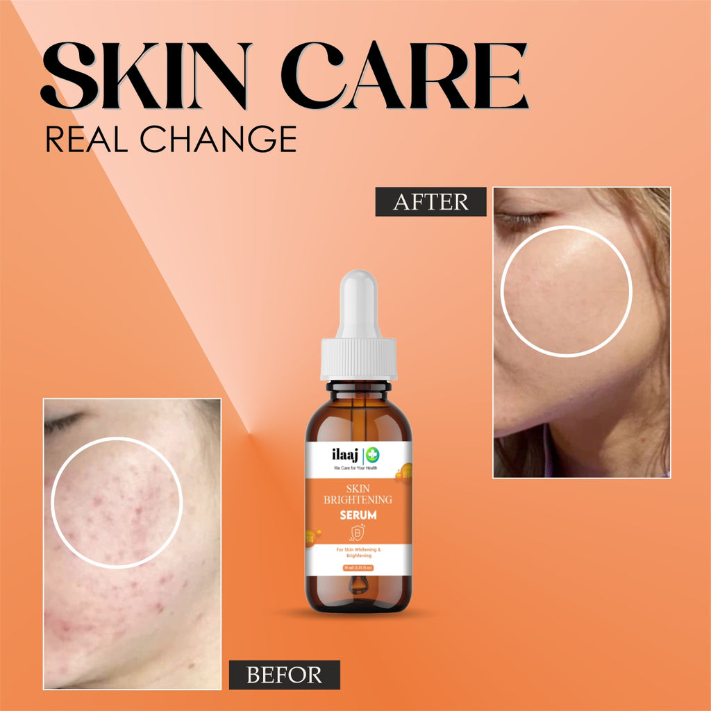Skin Brightening Face Serum, 30ml, With Niacinamide, For All Skin Types, Reduces Dark Spots and Fine Lines