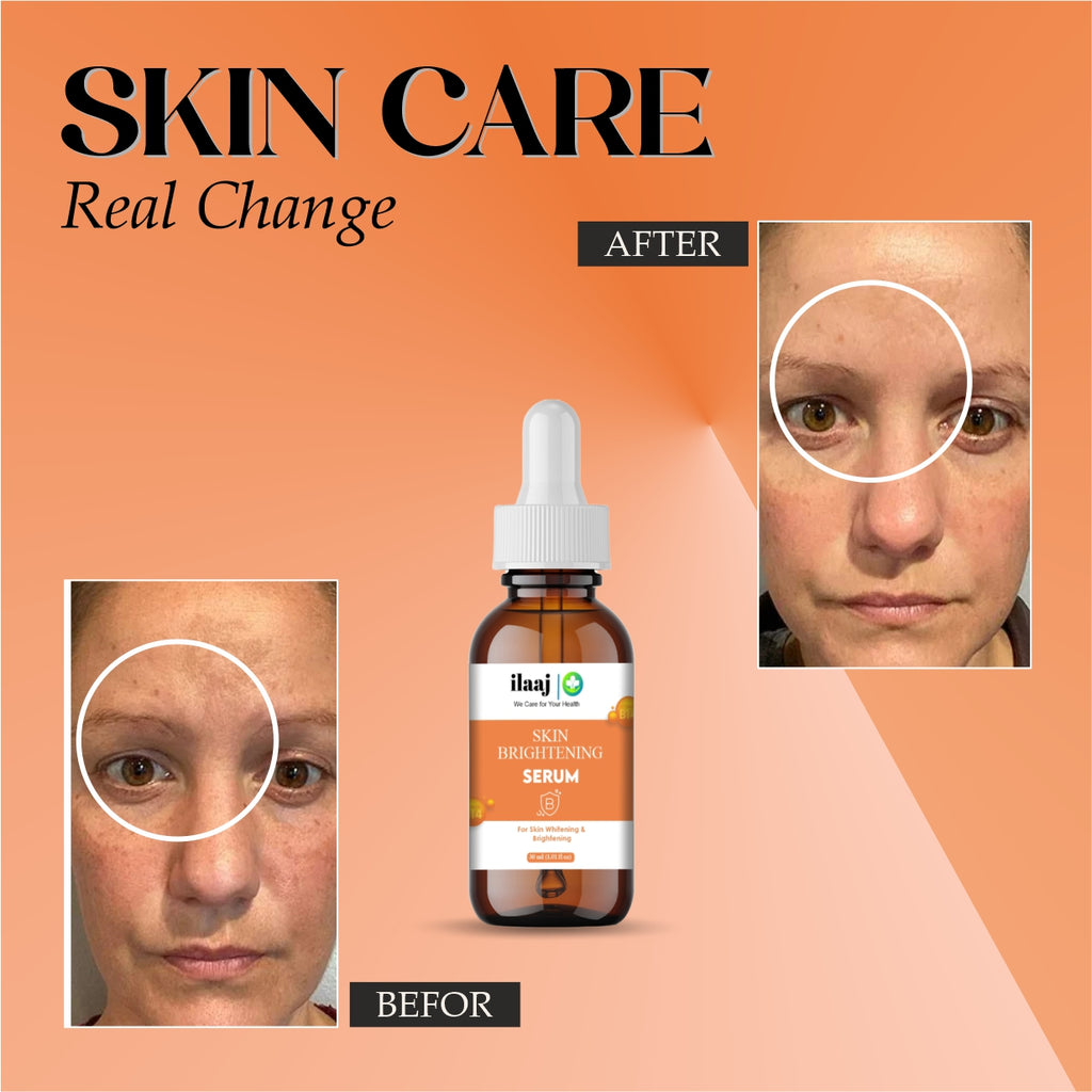 Skin Brightening Face Serum, 30ml, With Niacinamide, For All Skin Types, Reduces Dark Spots and Fine Lines
