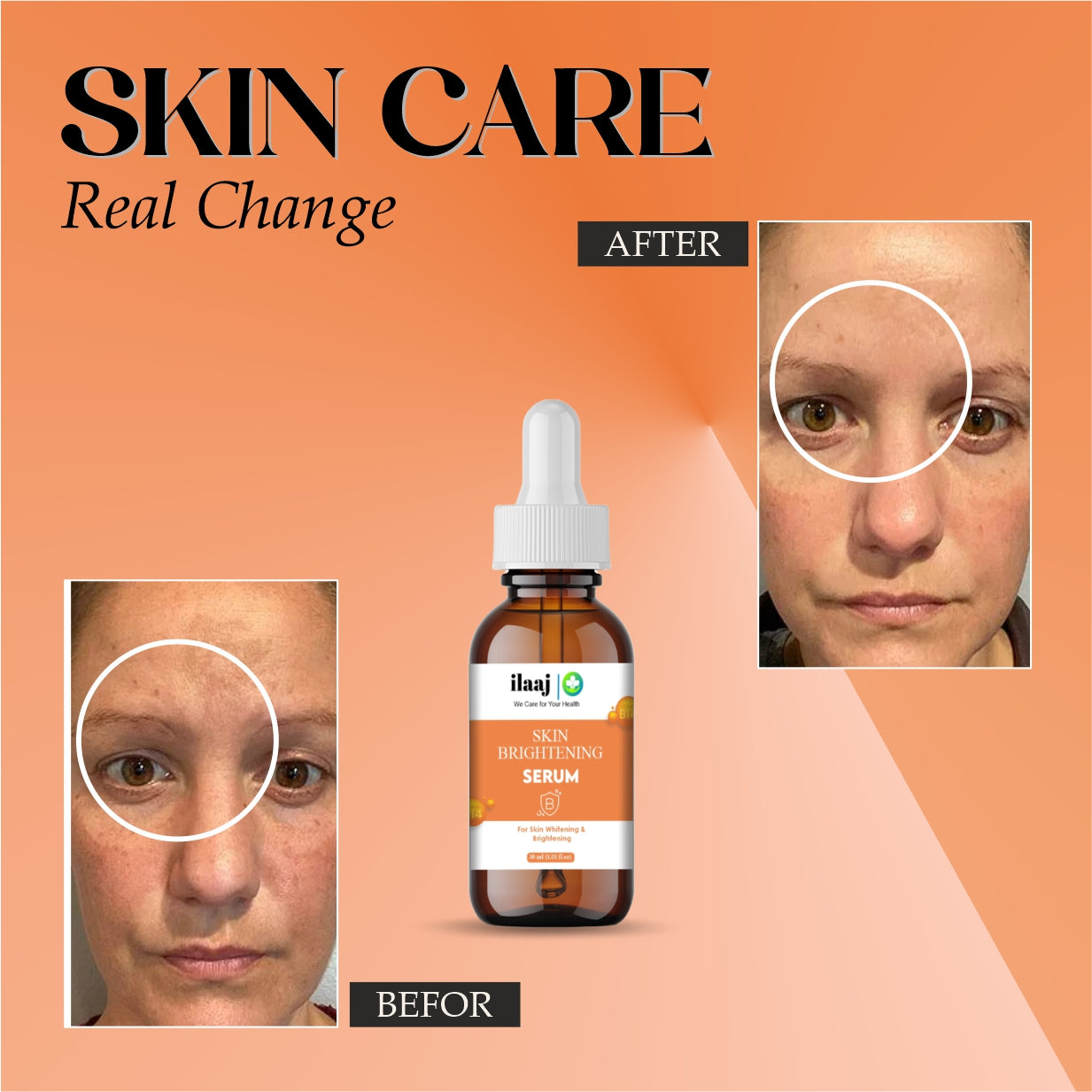 Skin Brightening Face Serum, 30ml, With Niacinamide, For All Skin Types, Reduces Dark Spots and Fine Lines