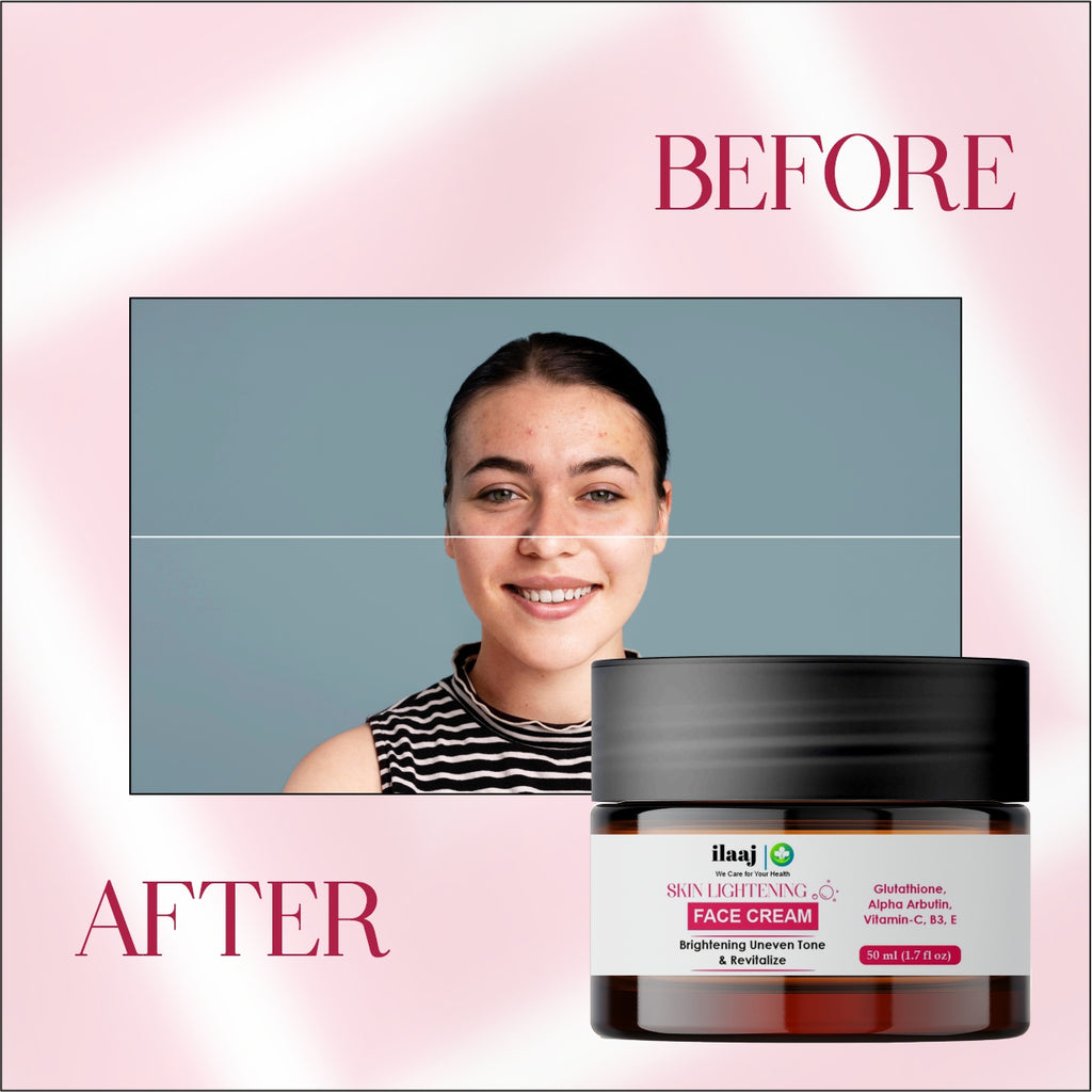 Ilaaj Skin Lightening Face Cream, Glutathione, Alpha Arbutin, Vitamin-C, B3, E, Brightening Uneven Tone & Revitalize, 50ml