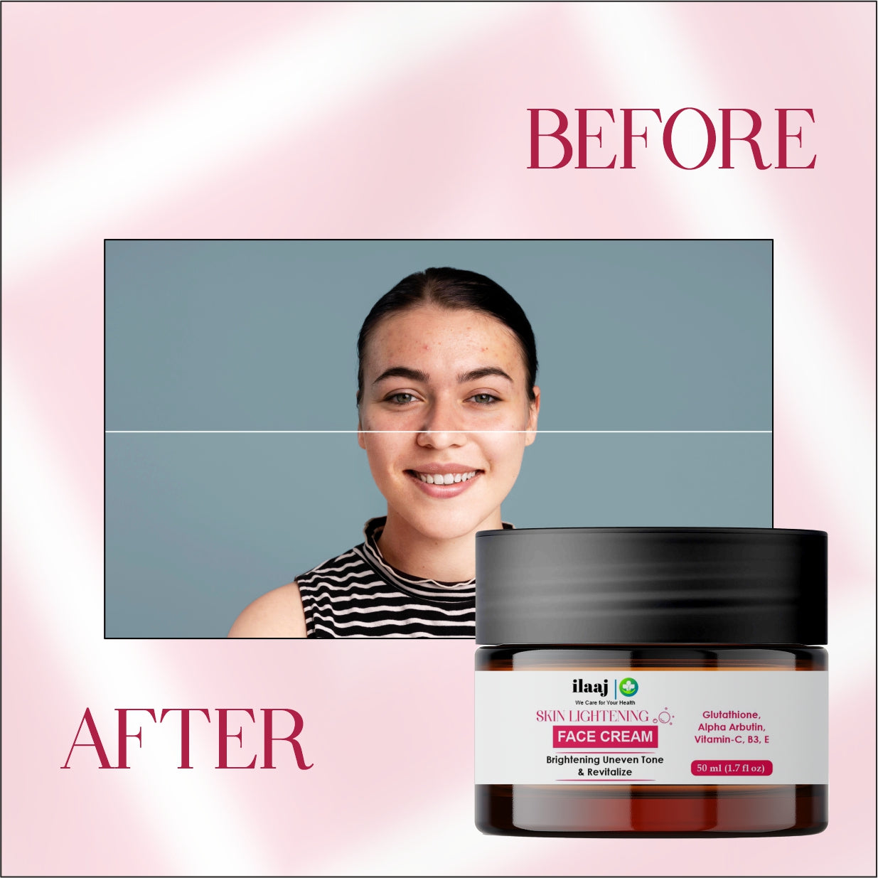 Ilaaj Skin Lightening Face Cream, Glutathione, Alpha Arbutin, Vitamin-C, B3, E, Brightening Uneven Tone & Revitalize, 50ml