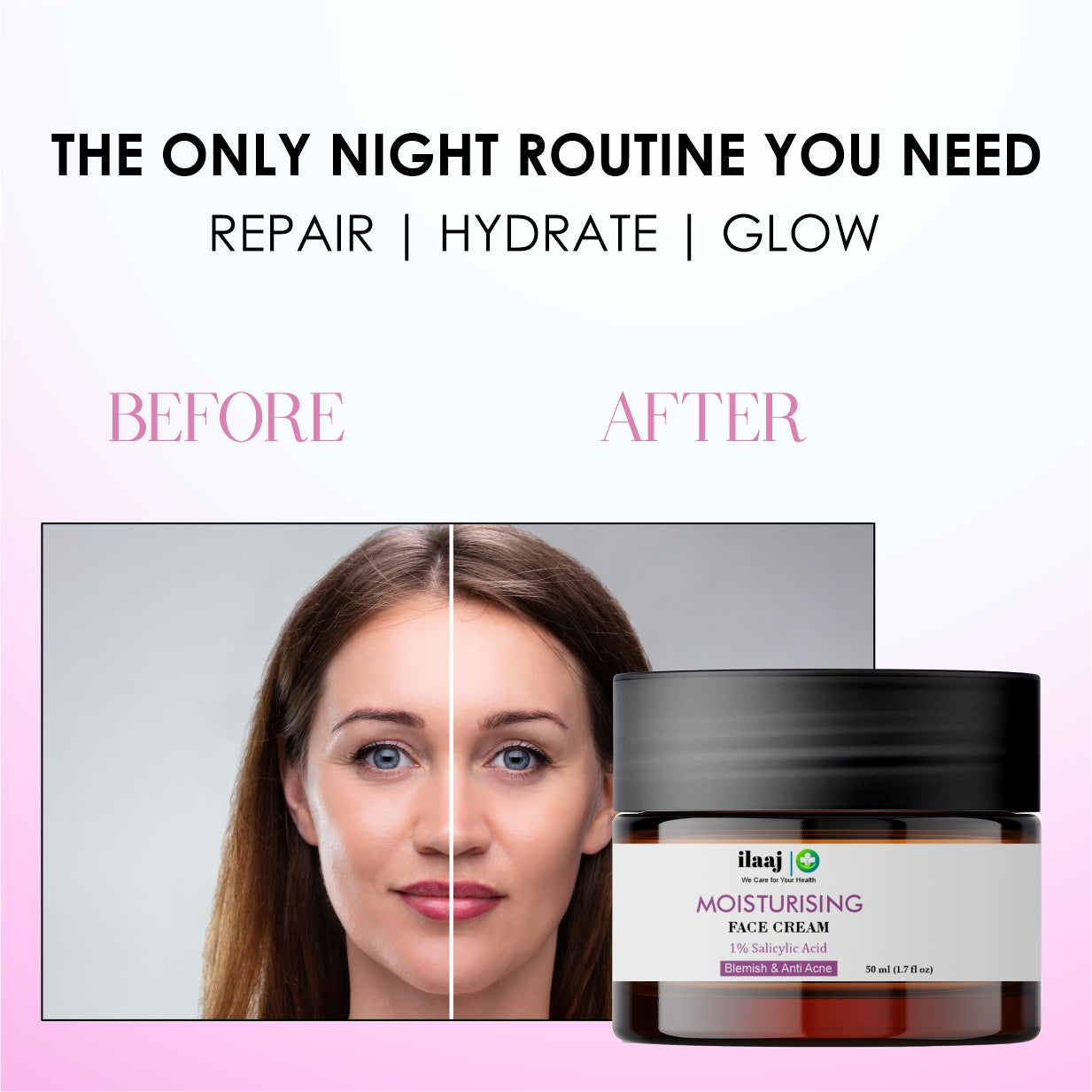 Ilaaj Moisturising Face Cream with Face Brighting , Blemish & Anti Acne Treatment, 50 ml