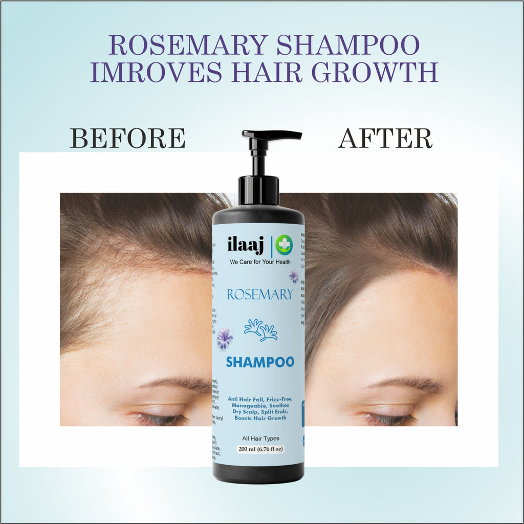Ilaaj Rosemary Shampoo, Anti Hair Fall, Frizz-Free, All Hair Types, 200ml