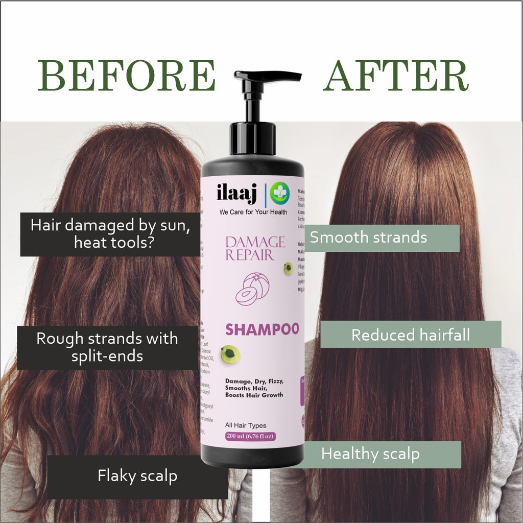 Ilaaj Damage Hair Repair Shampoo | For Itchy & Flaky Scalp Care | With Pyrithione Zinc | Suitable for All Hair Types | 200 ml